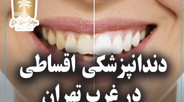 دندانپزشکی اقساطی در غرب تهران