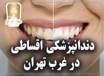 دندانپزشکی اقساطی در غرب تهران
