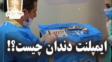 ایمپلنت دندان چیست؟