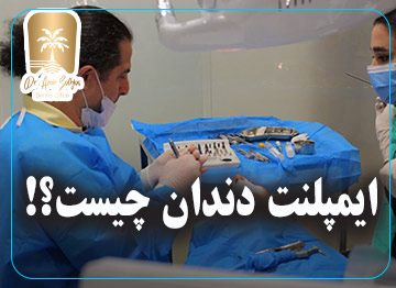 ایمپلنت دندان چیست؟