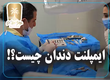 ایمپلنت دندان چیست؟