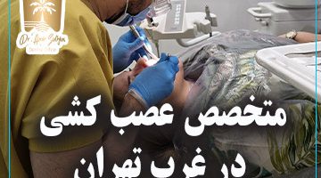 متخصص عصب کشی در غرب تهران