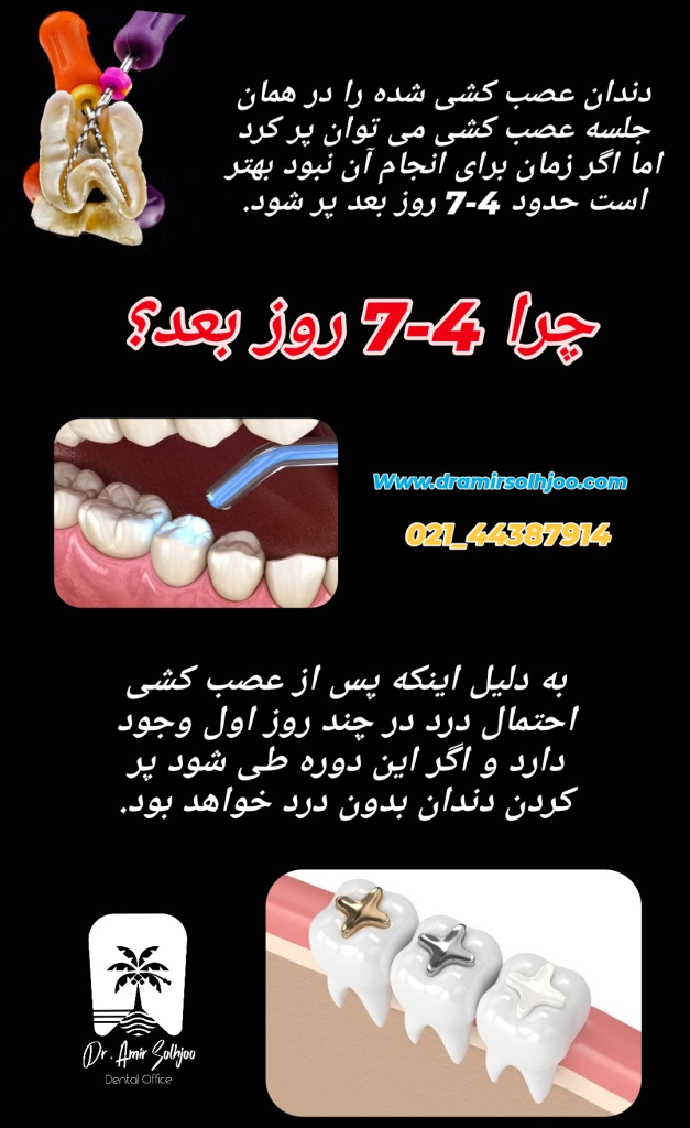 چند روز بعد عصبکشی دندان را پر کنیم