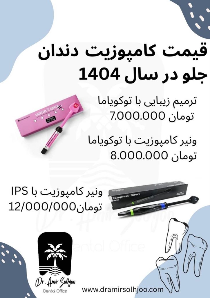 قیمت کامپوزیت دندان جلو در تهران