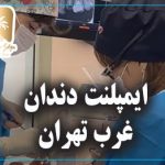 ایمپلنت دندان در غرب تهران