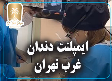ایمپلنت دندان در غرب تهران