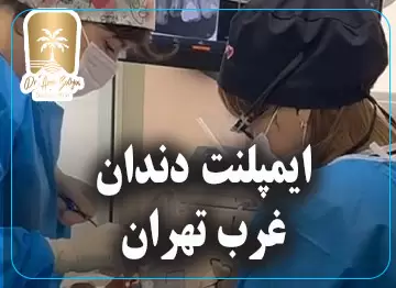 ایمپلنت دندان در غرب تهران