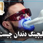 بلیچینگ دندان