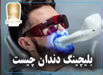 بلیچینگ دندان