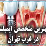 بهترین متخصص ایمپلنت در غرب تهران