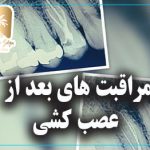 مراقبت های بعد از عصب کشی