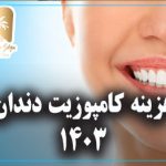 هزینه کامپوزیت دندان 1403