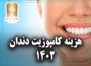 هزینه کامپوزیت دندان 1403