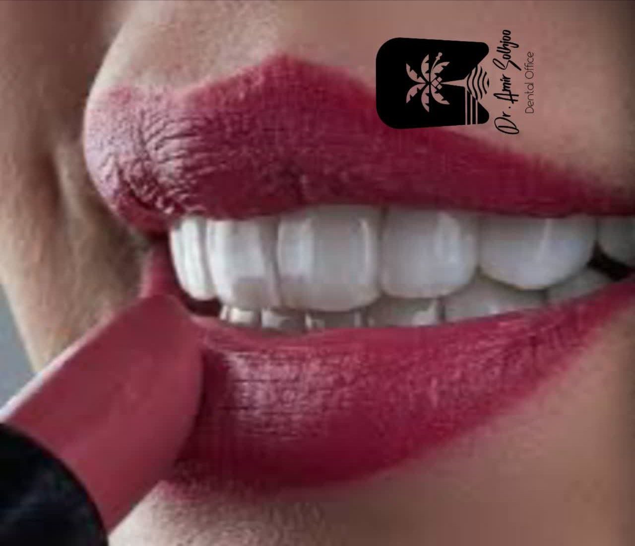 کامپوزیت آلمانی