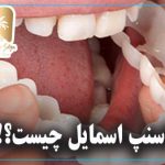 اسنپ اسمایل چیست؟!