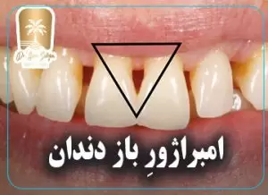 امبراژور