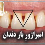 امبراژور