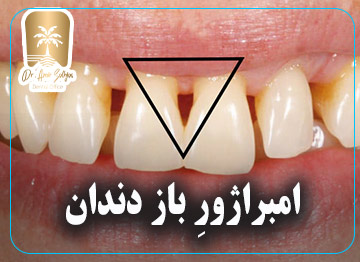 امبراژور