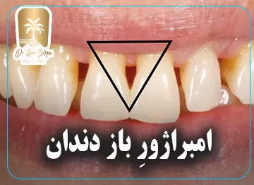 امبراژور
