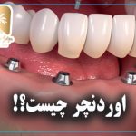 اوردنچر