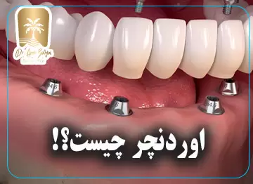 اوردنچر