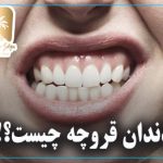 دندان قروچه