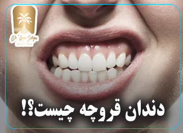 دندان قروچه