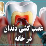 عصب کشی دندان در خانه