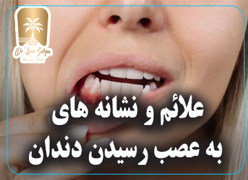 علائم به عصب رسیدن دندان