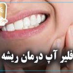 درد دندان پس از عصب‌کشی