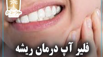 درد دندان پس از عصب‌کشی