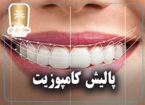 پالیش کامپوزیت