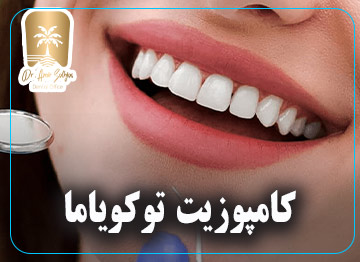 کامپوزیت توکویاما