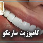 کامپوزیت سارمکو