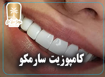 کامپوزیت سارمکو
