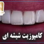 کامپوزیت شیشه ای