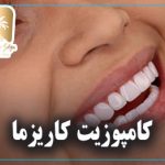 کامپوزیت کاریزما