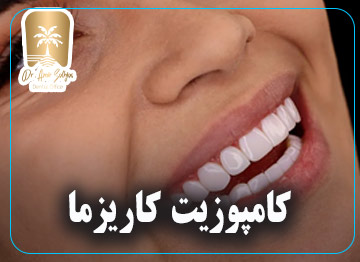 کامپوزیت کاریزما