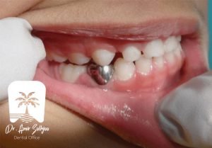 اس اس کراون ss crown