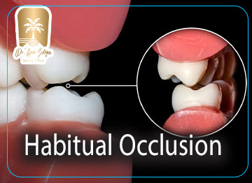 Habitual Occlusion