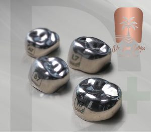 موارد استفاده اس اس کراون ss crown در دندانپزشکی