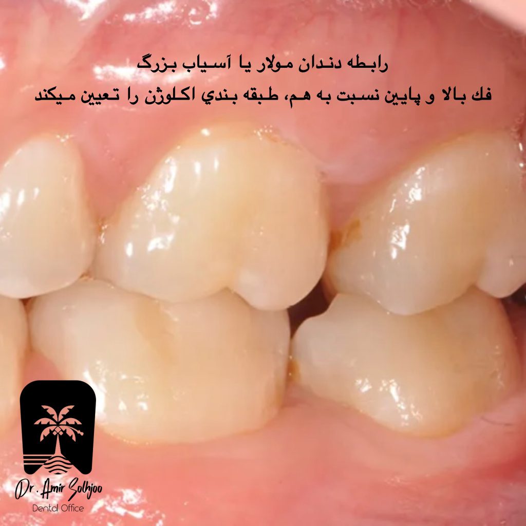 دندان مولر یا آسیاب بزرگ