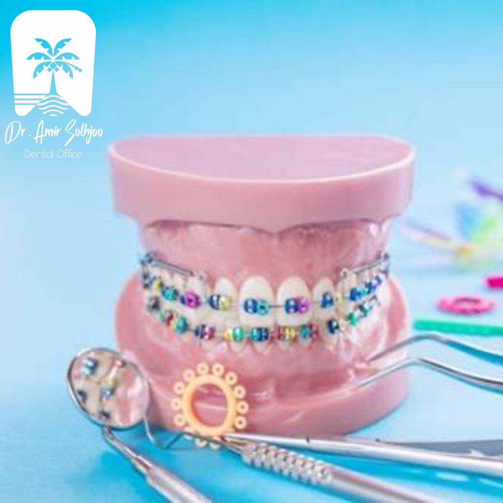 مزایای ارتودنسی: اصلاح دندانها بدون جراحی