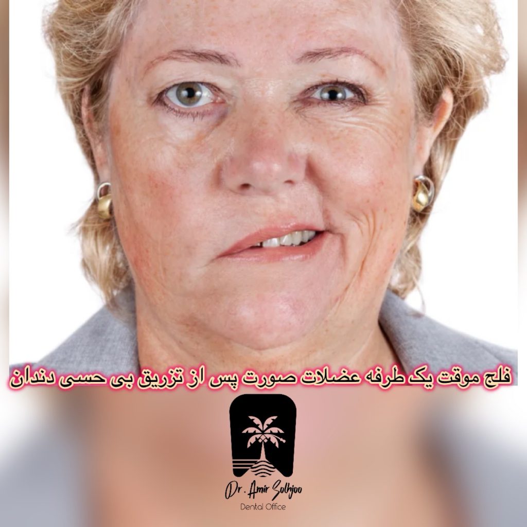 عوارض جانبی بی حسی دندان