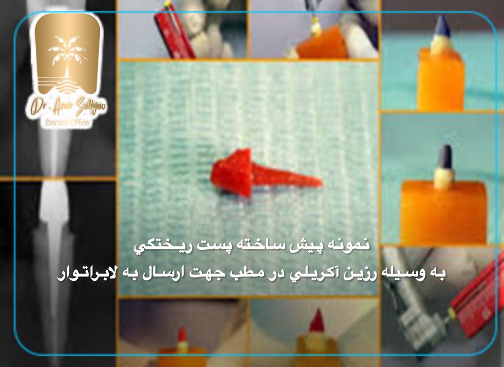 نمونه رزین آکریلی