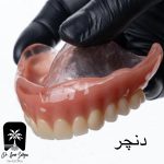 دنچر یا پروتز چیست