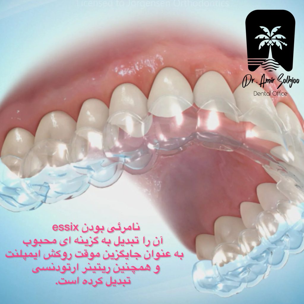 ریتینر essix نامرئی
