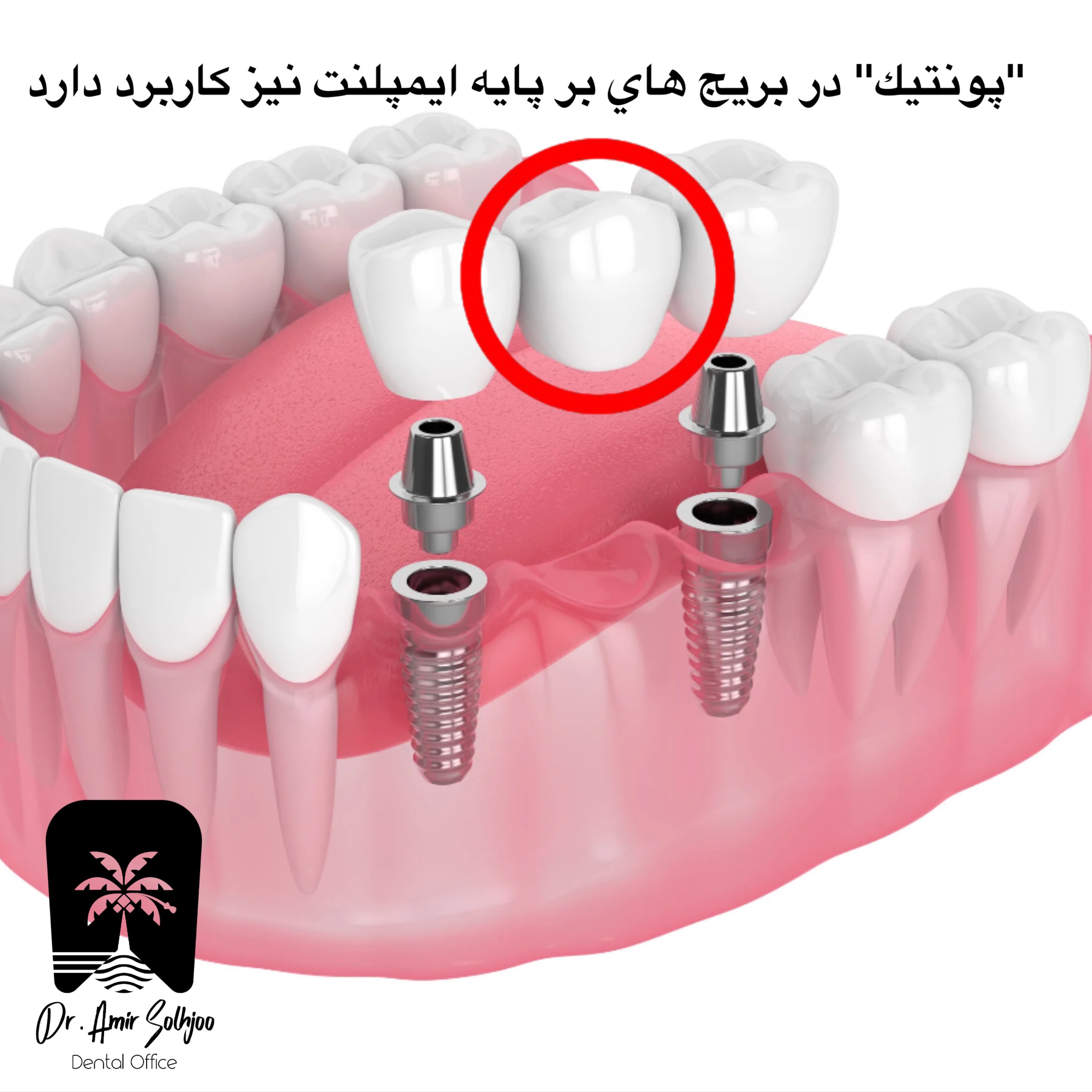 پونتیک