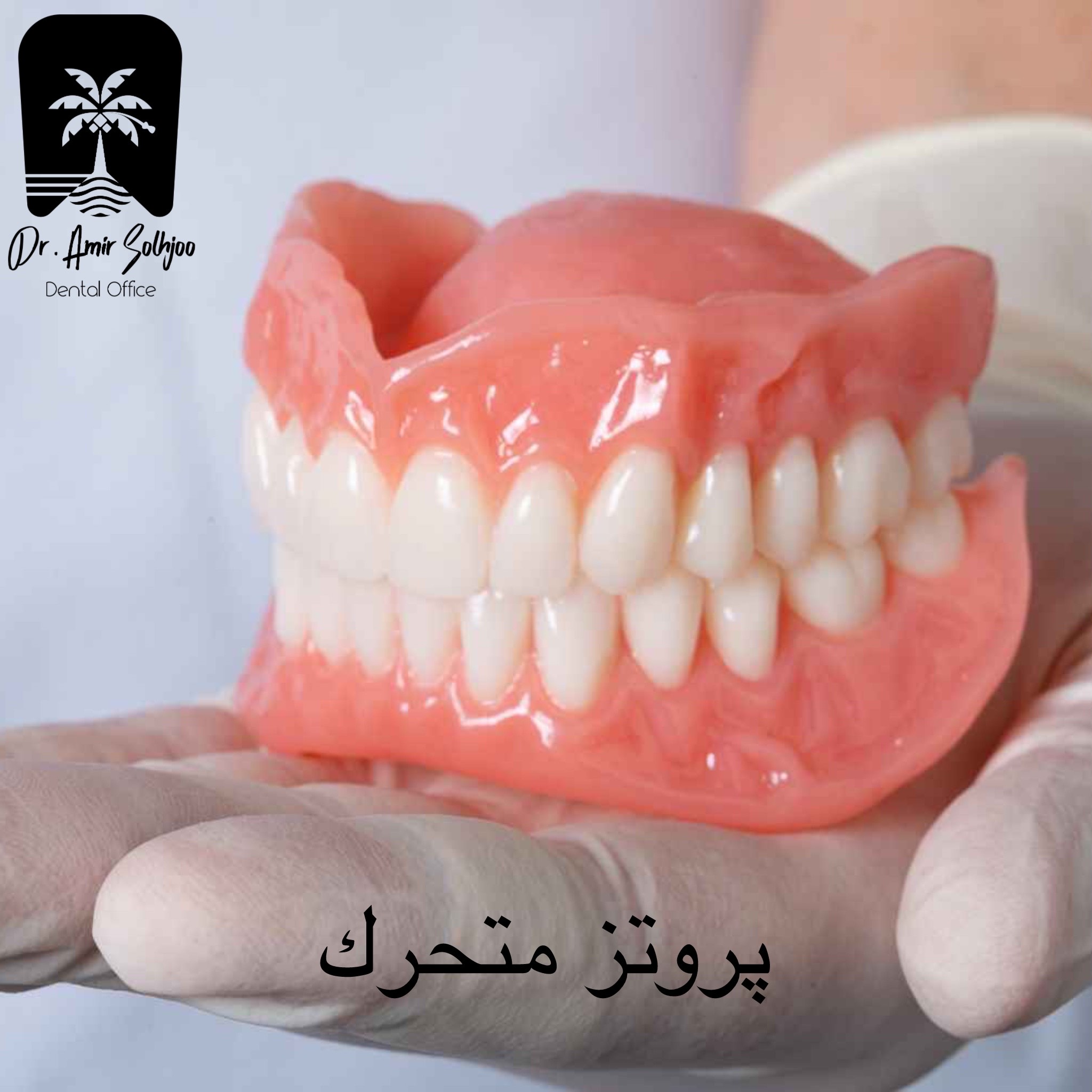 پروتز متحرک