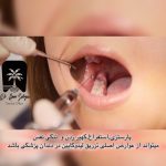 تزریق لیدوکائین در دندانپزشکی